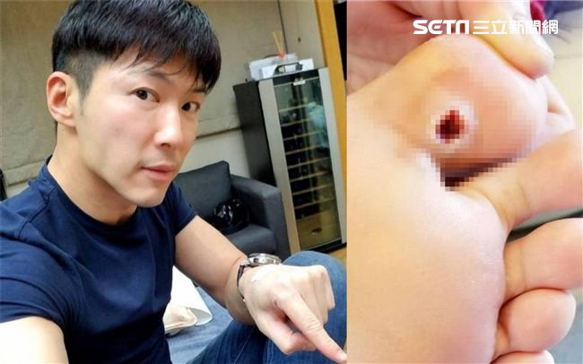 金彥鈞回來啦！開拍前火速進醫院挖肉