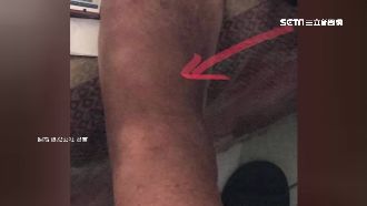 愛心筆入侵醫院？病患家屬：不買踩腳