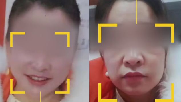 美少婦做微整狂殺價　術後驚見大媽臉
