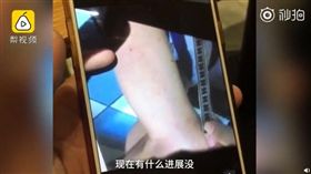 大陸幼兒園驚傳老師用牙籤針扎孩童事件。（圖／翻攝梨視頻）