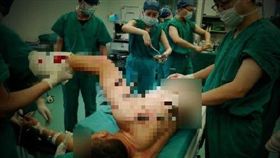 中國大陸,工人,男子身體遭鋼釘刺穿（圖／翻攝自微博）