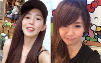 郭書瑤拆牙套對比照！這些改變超明顯