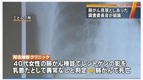 （圖／翻攝自東京MX新聞）日本,誤診,肺癌,乳頭