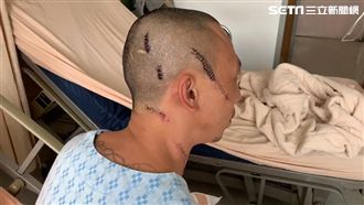 喬攤商債務反遭砍　他稱警關係不單純