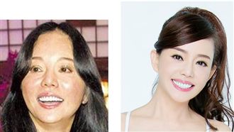 狄鶯代言醫美補錢坑?診所曝續約關鍵