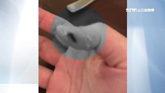 幫女嬰買兒童湯匙…媽媽先遭劃傷濺血