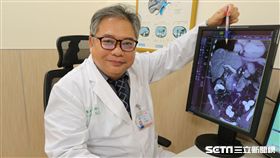 醫師王博民說明肝癌腫瘤生長過程。（圖／亞大醫院提供）