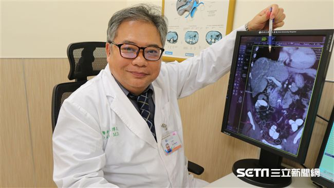腫瘤如千層派堆疊　醫靠它幫「消腫」
