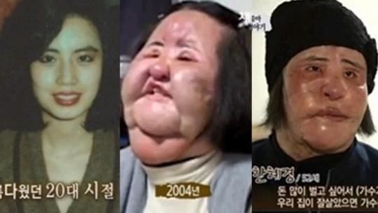 電風扇阿姨驚傳過世　毀容前美照曝光