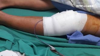 國中籃球賽摔傷膝蓋　父控校延誤就醫