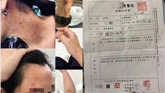 嗆打到流產！她挺孕肚遭健身男友痛毆