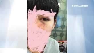 惡煞聖誕晚會闖校園！學生遭毆變熊貓