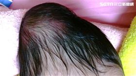 8天大男嬰染菌癱瘓／中國附醫提供