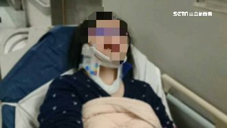 遭酒駕女撞！3歲子哭喊：救救我媽