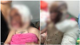 大陸,新疆,雙胞胎,火爐,燒傷(圖/翻攝自梨視頻)