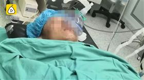 驚悚！知名演員吞劍爆失誤 真的插進去「刺穿食道」（圖／梨視頻）