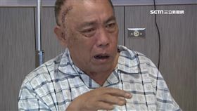 日吃1斤焢肉! 男子腦出血中風半癱送醫