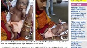 出生就有3隻手…女嬰竟被印度人膜拜
（圖／翻攝自dailymai）

