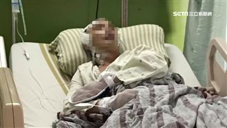 返家遇惡煞逆向衝撞　男顱內出血昏迷