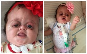 英國,女童貝雅（Batya）,罕見疾病（圖／翻攝自臉書）