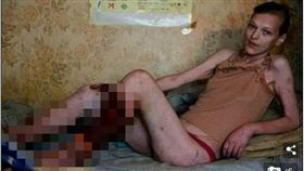 鱷魚,毒品,腐爛,Krokodil,海洛因(圖/翻攝自每日郵報)