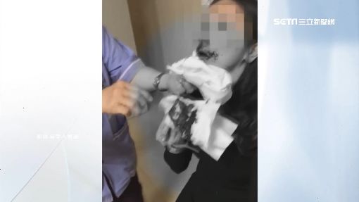 恐怖!健身男友怒揮拳 女友斷鼻「滿臉血」