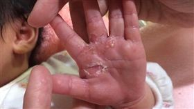 台中,護理之家,膿皰,髒污,隔離（圖／翻攝自爆料公社臉書）