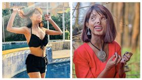 小時候被父親潑酸他勇敢活出自我。（圖／取自IG／anmol_rodriguez_official）