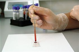 驗血,血型(圖/PIXABAY)