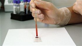 驗血,血型(圖/PIXABAY)