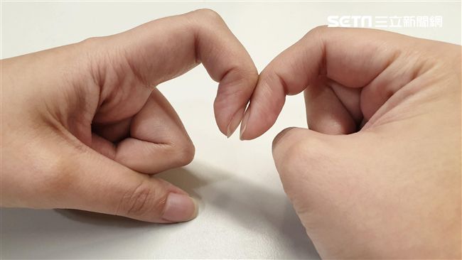 快看！老翁驚覺「手指異樣」癌末過世