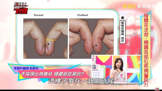 6旬翁手指「怪怪的」！就醫後竟癌末