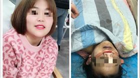 大陸19歲嫩妹隆鼻失敗慘死…醫院「河蟹」真相惹網友怒火（圖／翻攝自微博）