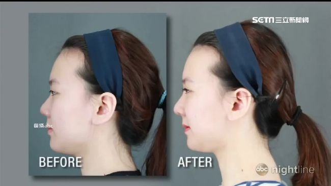 就是要整型！盤點南韓正妹整型模仿史