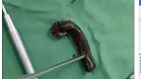 喉嚨深處在蠕動？越南婦頭痛喉嚨痛　手術竟夾出一隻大水蛭（圖／翻攝自DailyMail）