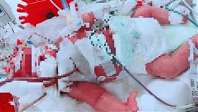 網友用自身的經驗呼籲家長不要輕忽新生兒的任何症狀。（圖／網友授權提供）