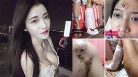 新北,三重,車禍,計程車,失禁,粉碎性骨折