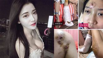 白皙正妹遭追撞　大小便失禁還被反告