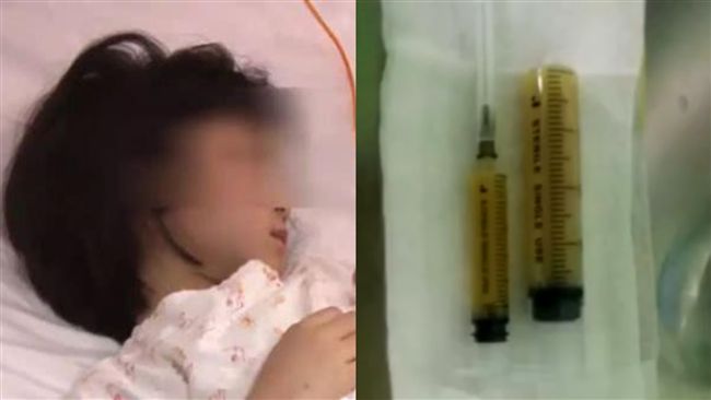 童發燒「左肺淹滿膿」　氣管慘被壓歪