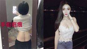 新北,正妹,追撞,大小便失禁,計程車,粉碎性骨折。翻攝畫面