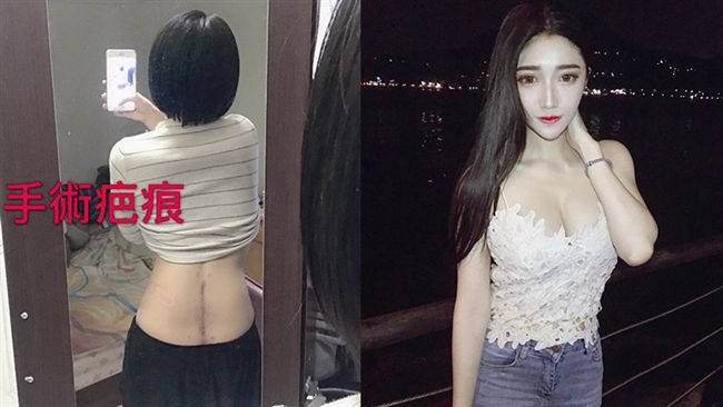 正妹遭撞大小便失禁　網友湧臉書送暖