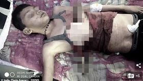 印男童樹枝刺穿胸膛　竟忍痛牽妹回家 （圖／翻攝自dailymai）