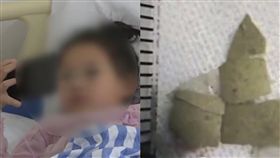 蛋殼,大陸,咳血,動脈,食道,卡住,吞嚥,割破,手術,遼寧　圖／翻攝自微博　