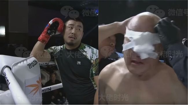 30秒腫成豬頭！武術大師慘敗徐曉冬