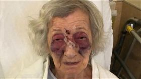 稱共乘男「有侵略性」要老婦當心　92歲嬤發車就遭爆打（圖／翻攝自CBC）