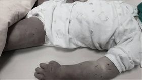 台南,虐童,刀傷,郭綜合醫院,家暴,女童（圖，經變色處理／翻攝自爆料公社）