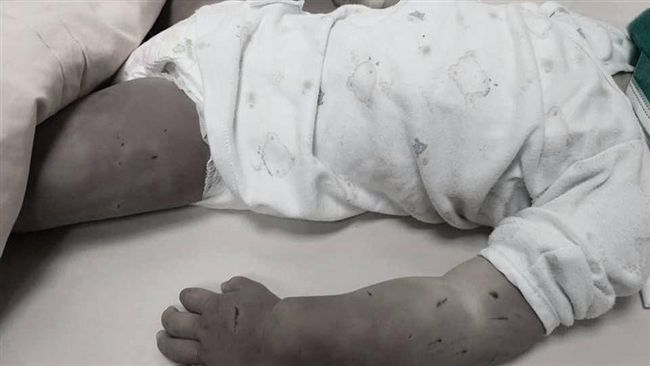 台南女童遭虐死　生父：爸爸對不起妳