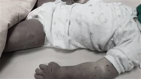 台南,虐童,刀傷,郭綜合醫院,家暴,女童（圖，經變色處理／翻攝自爆料公社）