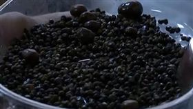 膽結石
翻攝自看看新聞