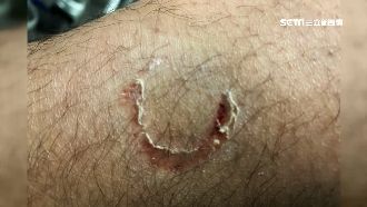 酒駕伯未戴帽被攔　拒酒測竟張嘴咬警